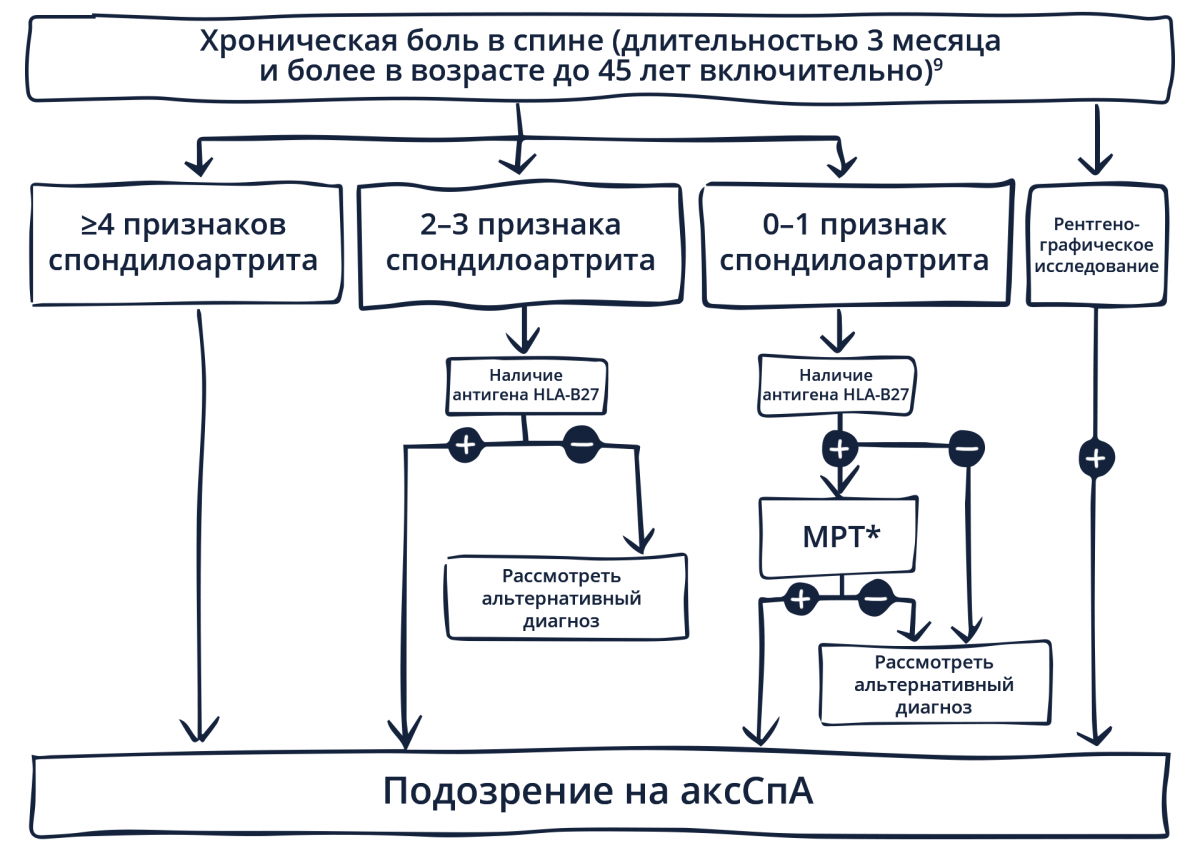 Выявление аксСпА