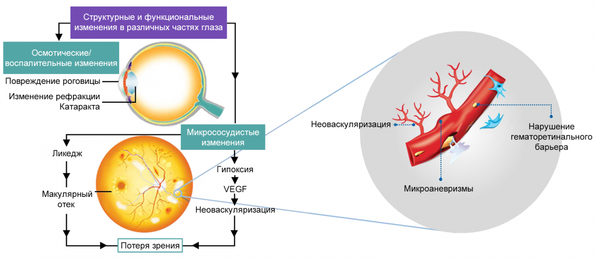 Рисунок 2. Патогенетические механизмы ДР Патогенетические механизмы ДР