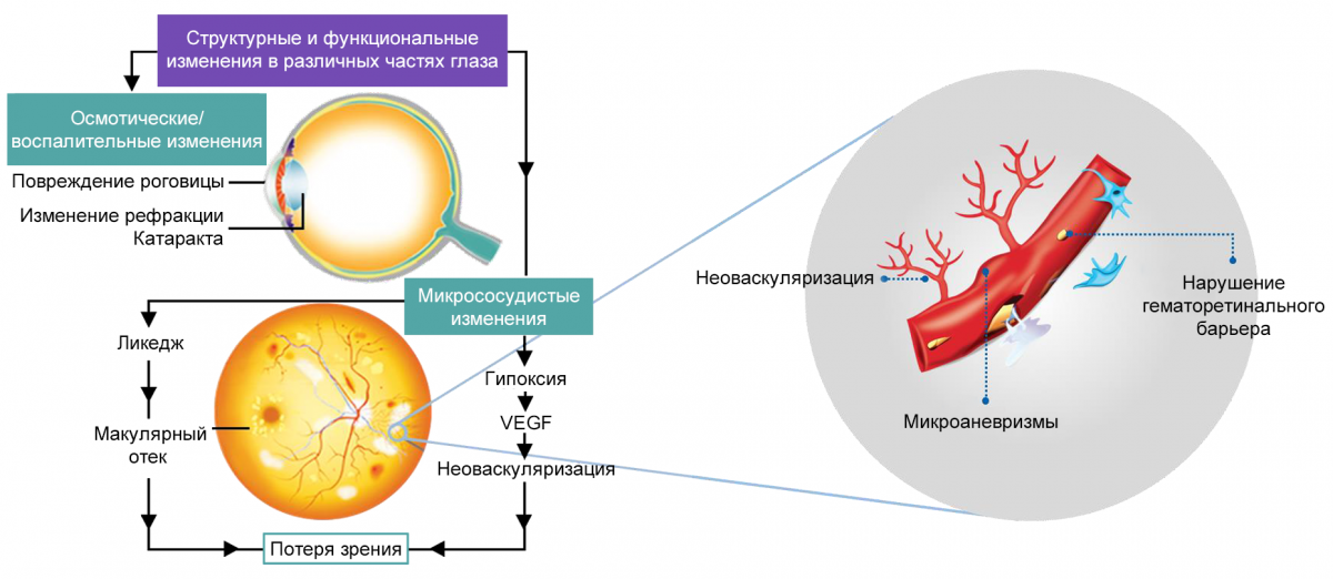 Патогенетические механизмы ДР