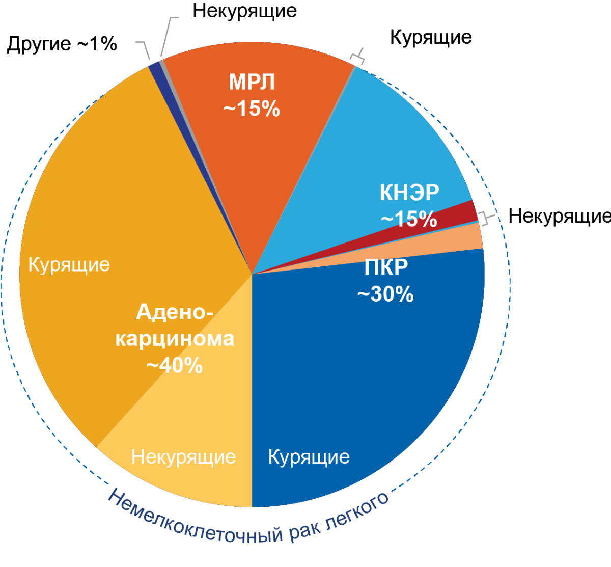 Рисунок 3. Гистологические варианты рака легкого Гистологические варианты рака легкого