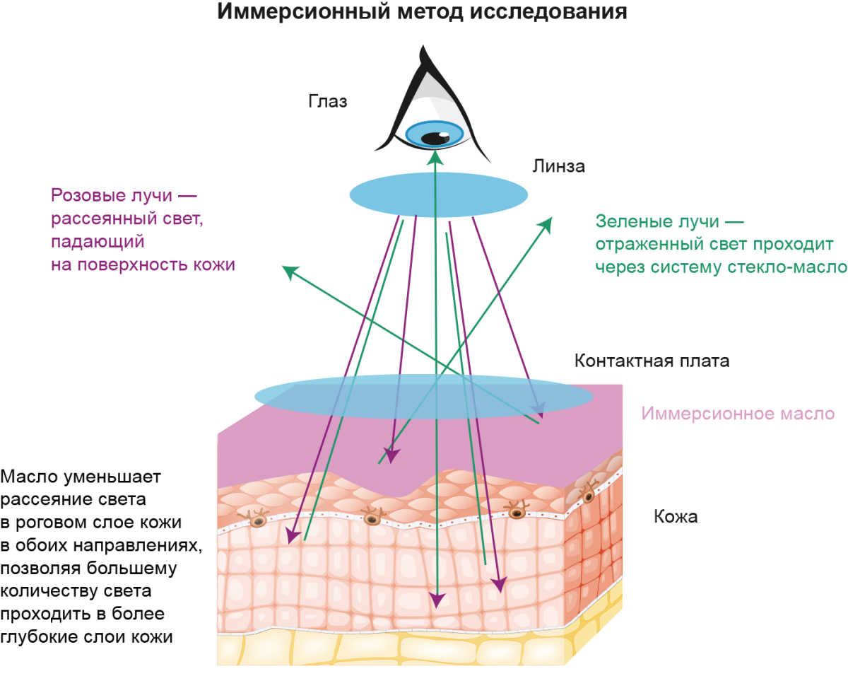 Рисунок - Иммерсионный метод исследования Иммерсионный метод исследования