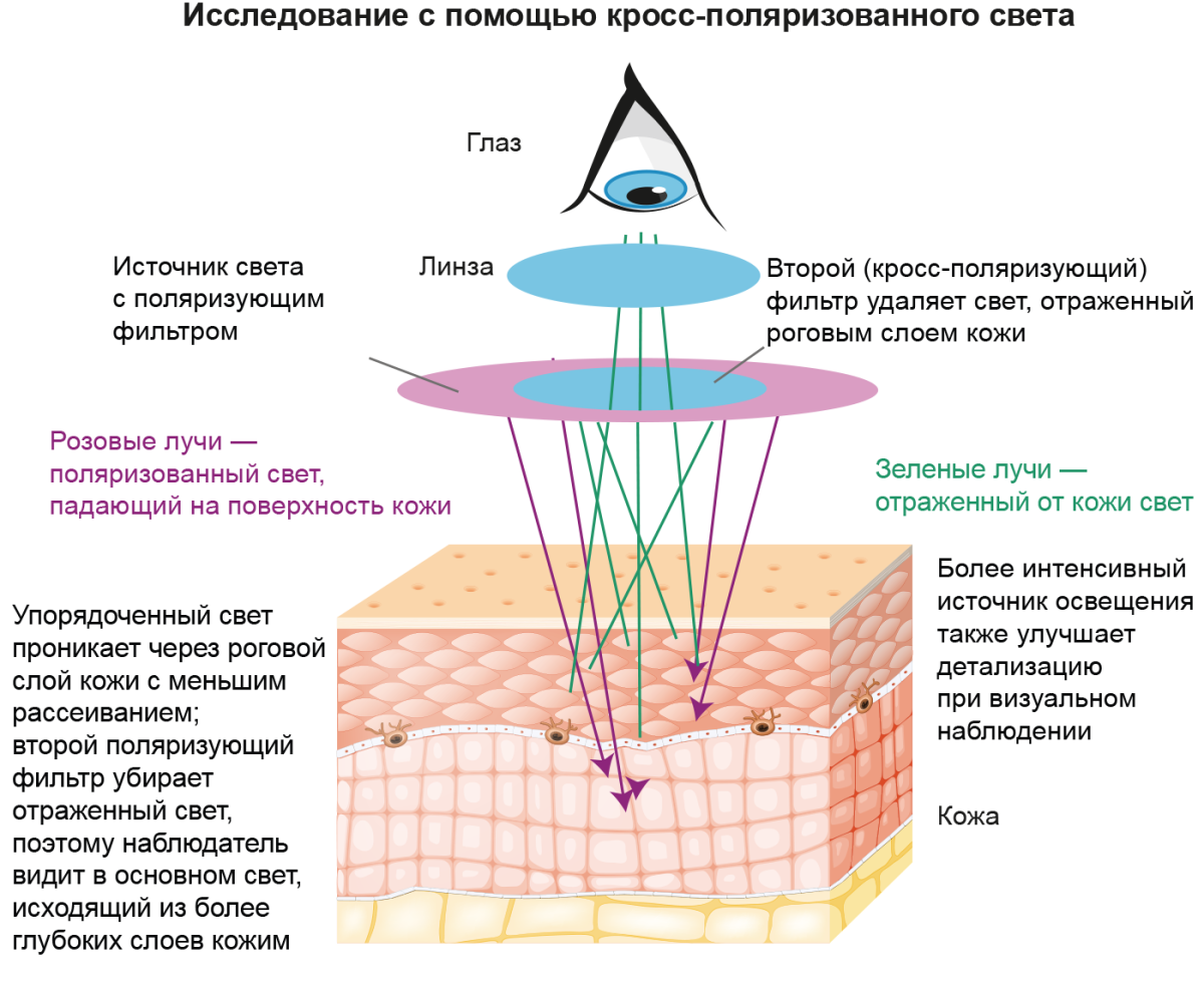 Рисунок - Исследование с помощью кросс-поляризованного света Исследование с помощью кросс-поляризованного света