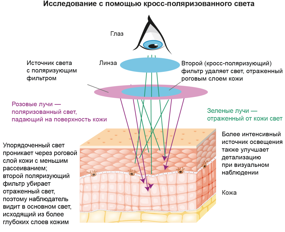 Исследование с помощью кросс-поляризованного света