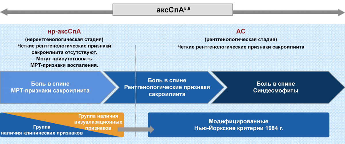Рисунок 2 — Спектр аксиального спондилоартрита (аксСпА) Спектр аксиального спондилоартрита (аксСпА)