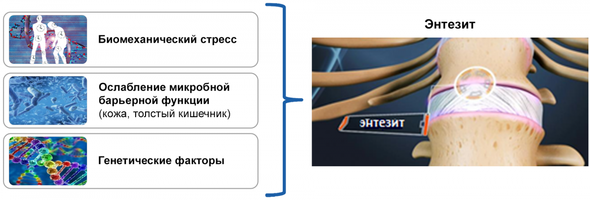 Рисунок - Энтезит Энтезит