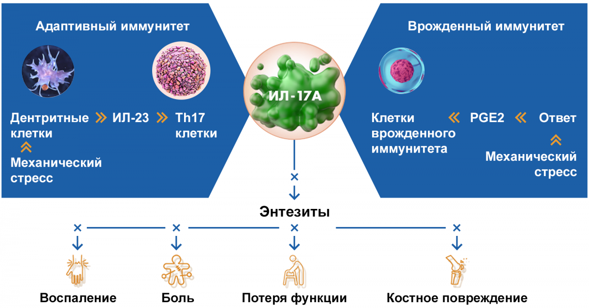 ИЛ-17А