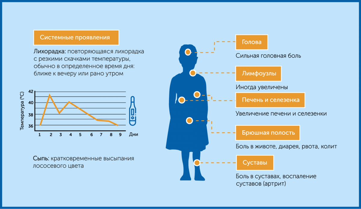 Основные симптомы сЮИА