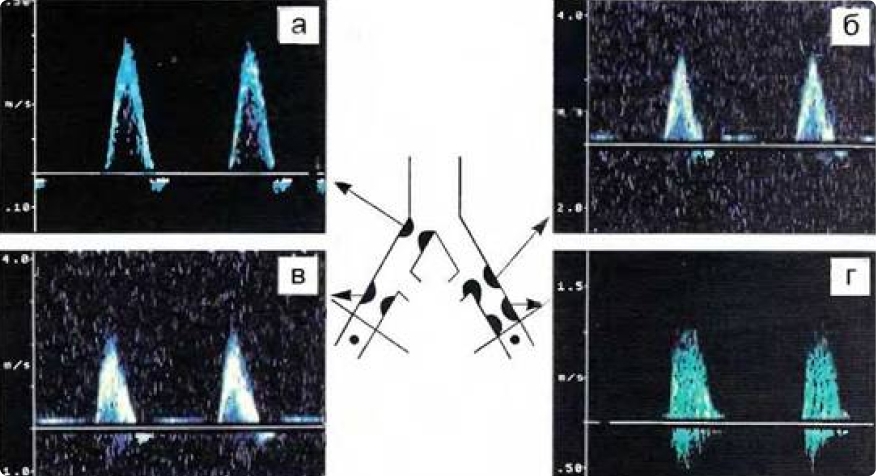 Spectral analysis of blood flow