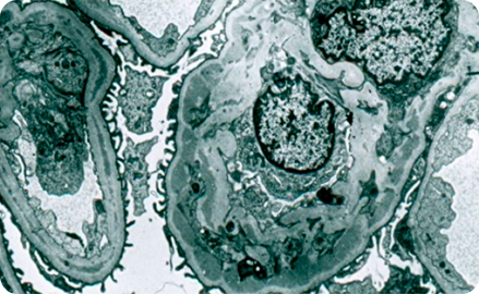 Электронная микроскопия в нефрологии